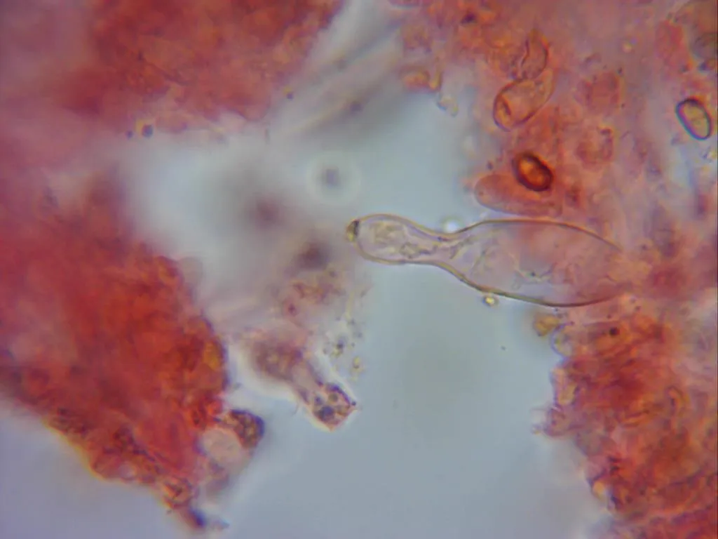 Microscopía de Pholiota flavida - 10 - Queilocistidio 2